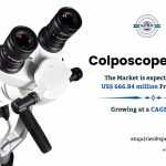 Colposcope Market Share, Size, Trends, Growth, Scope and Forecast 2034: SPER Market Research