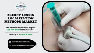 Breast Lesion Localization Methods Market